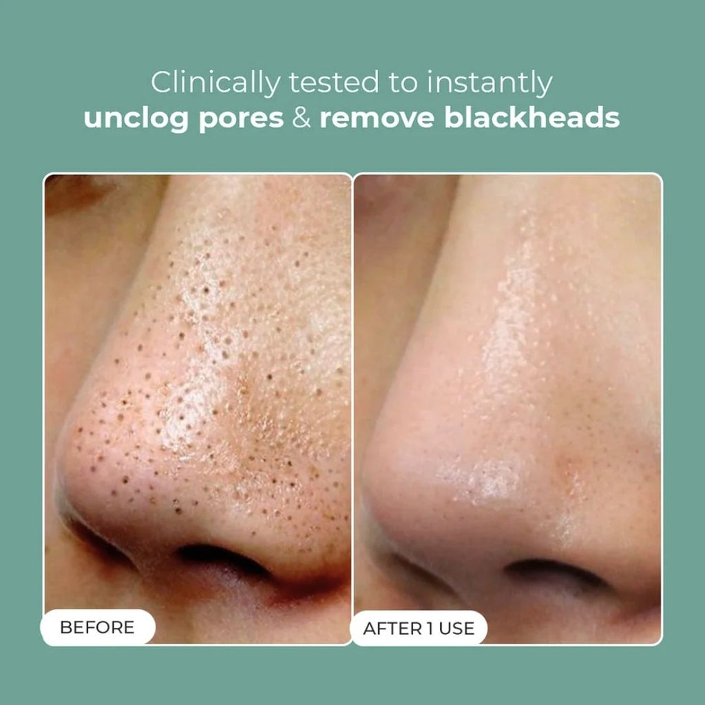 Glycolic Acid 7% Exfoliating Toner