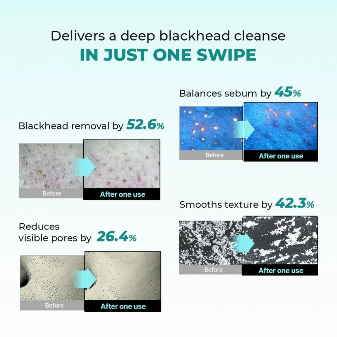 Glycolic Acid 7% Exfoliating Toner