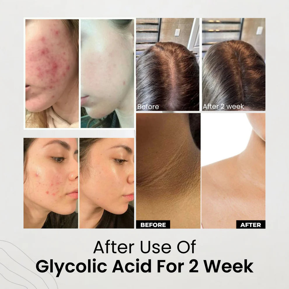 Glycolic Acid 7% Exfoliating Toner